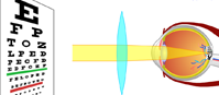 Wady wzroku (flash) Wady wzroku (flash)